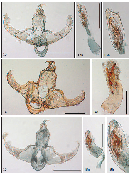 Male genitalia: 13. Lecithocera lunulata Park & Mey, sp. n.; 13a. ditto, aedeagus; 13b. ditto, close-up aedeagus; 14. L. distigmata Park & Mey, sp. n.; 14a. ditto, aedeagus; 15. L. stenocaltalexis Park & Mey, sp. n.; 15a. ditto, aedeagus; 15b. ditto, close-up aedeagus. Scale bar: 0.5 mm.