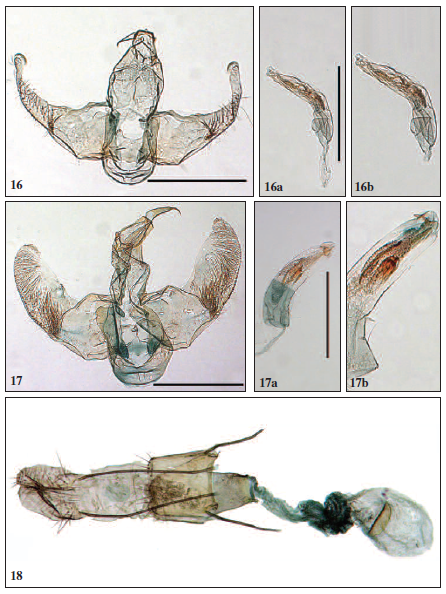 Male and female genitalia: 16. Lecithocera strigana Park & Mey, sp. n.; 16a. ditto, aedeagus; 16b. ditto, close-up aedeagus; 17. L. castanoma Wu; 17a. ditto, aedeagus; 17b. ditto, close-up aedeagus; 18. Female genitalia of L. strigana Park & Mey, sp. n. Scale bar: 0.5 mm.